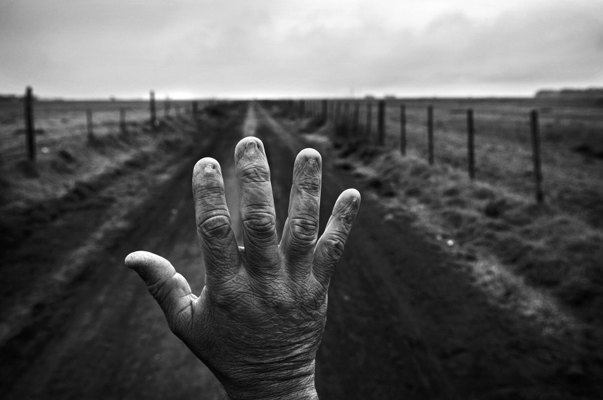 El argentino Pablo Piovano fue uno de los ganadores en la categoría  Proyectos a largo plazo por su obra El costo humano de los agrotóxicos que  muestra malformaciones genéticas de personas que