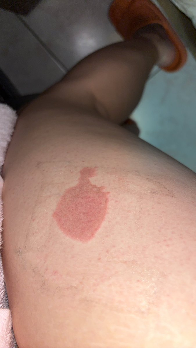 772🎀kiki tweet media