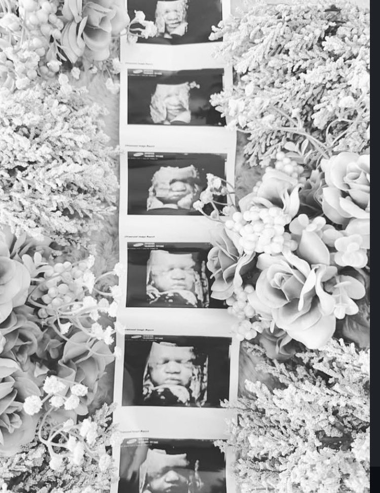 BlackMedia__ tweet media