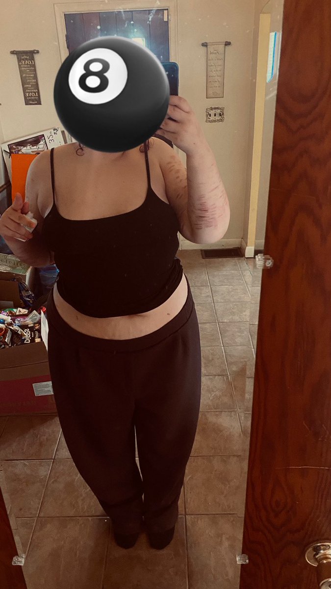 urmom6455687's tweet image. so i hate being fat skinny. 
#fatspo #shedtwt