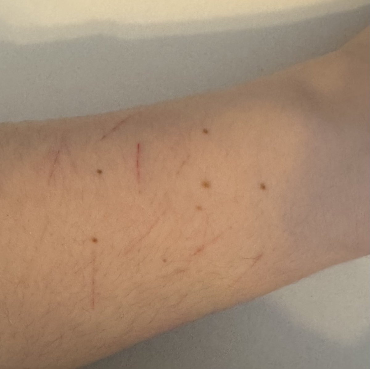 Kora ᥫ᭡ (of shedtwt) tweet media