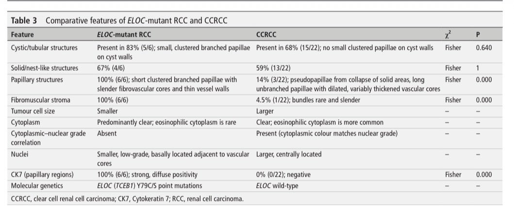 katcollmd's tweet image. Nice work by the authors—practical morphologic and IHC clues (cystic branching papillae, CK7 patterns) plus molecular confirmation to separate ELOC-mutant RCC from mimics 👏 #readinglist #pathreads #gupath @jclinpath_BMJ @Vik_deshpandeMD

🔗 jcp.bmj.com/content/79/4/2…