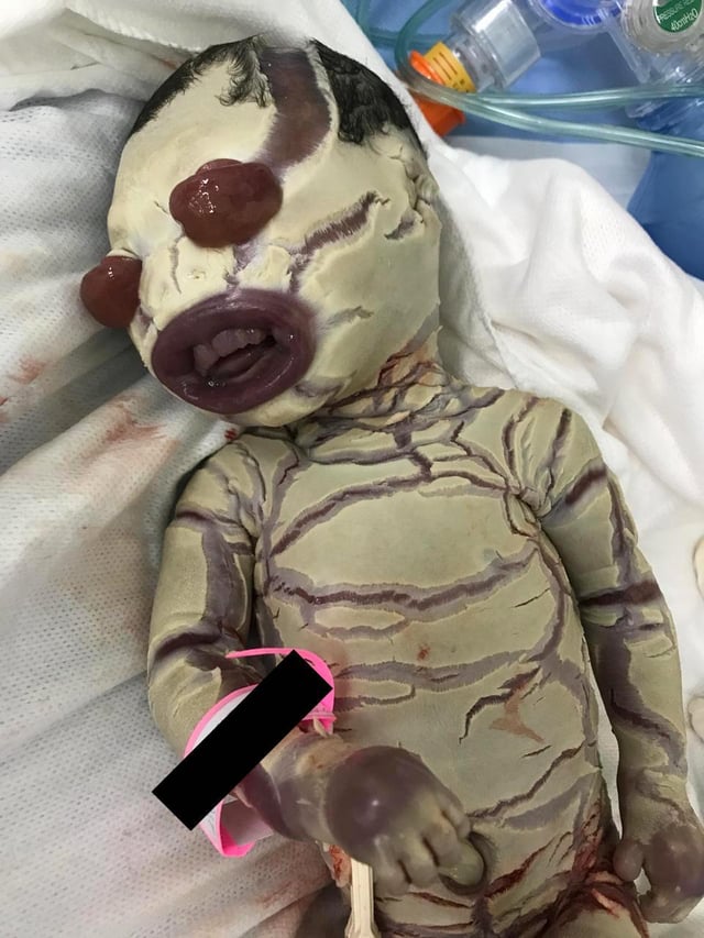 Dr Abdul Hameed 🩺 tweet media