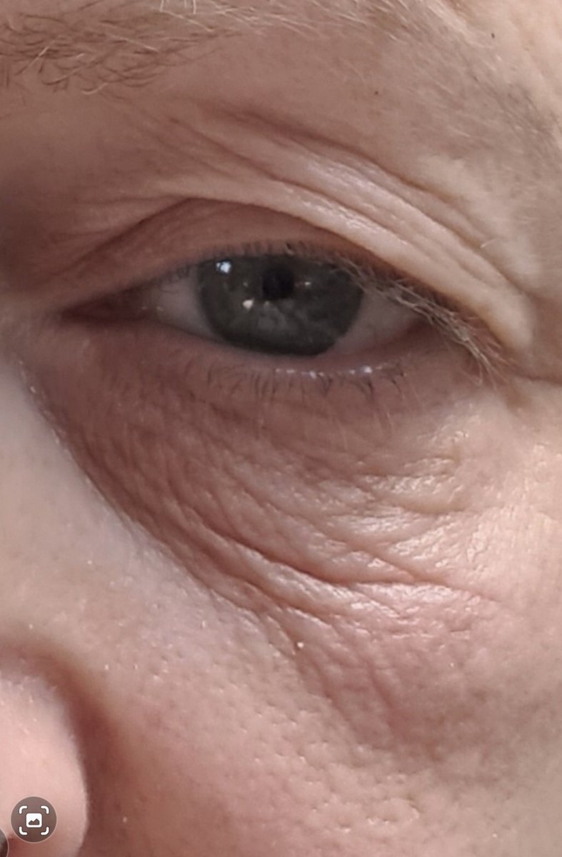 nmoaksom's tweet photo. Sculptra: Natural, Long-Lasting Facial Rejuvenation - https://t.co/PvO7hKvVRN https://t.co/7y6PTzfu8k
