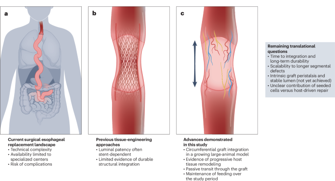 NatureBiotech's tweet photo. @paolodecoppi @GreatOrmondSt @UCLchildhealth @KU_Leuven @TheCrick @juntendo1838 @ucl @OfficialUoM @uclgenomics Esophagus engineering tackles function #NBTNV https://t.co/JX7hHu2mGx https://t.co/3wF1g1iQXi