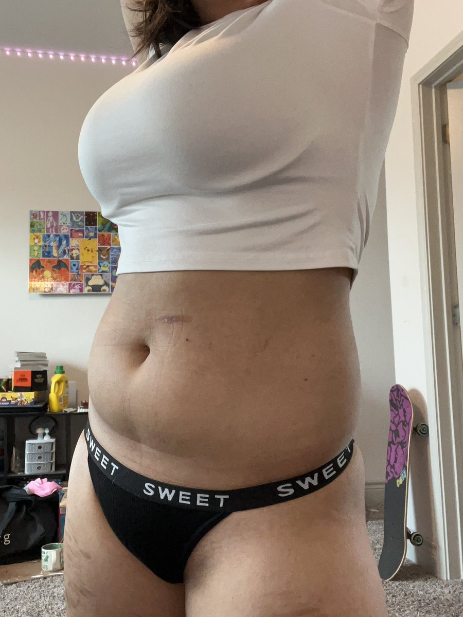 disordereddoggy's tweet photo. BMI guesses?? O.O #bodycheck https://t.co/YATuEm9ZO0