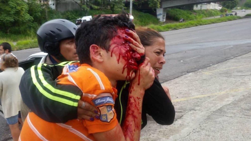 Johan Lozada tweet media