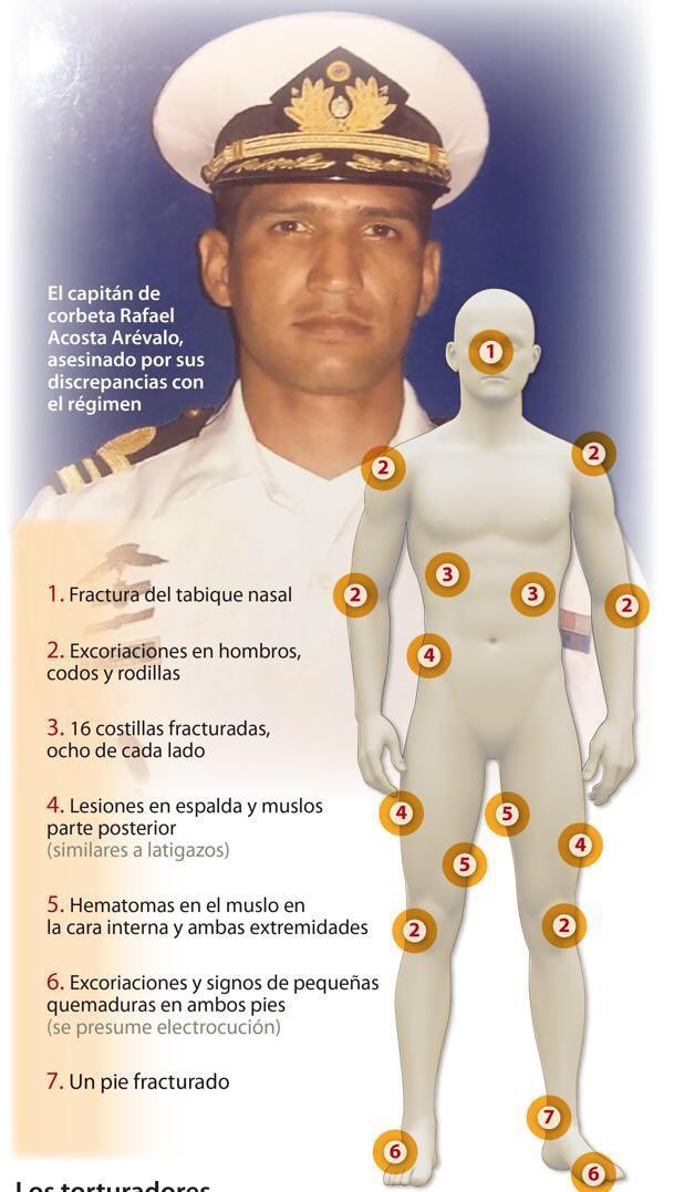 No es un error.

Es un crimen de lesa humanidad.