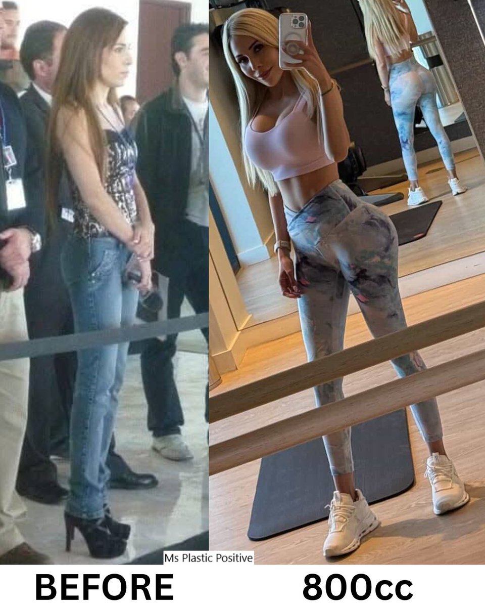 Ms Plastic Positive tweet media