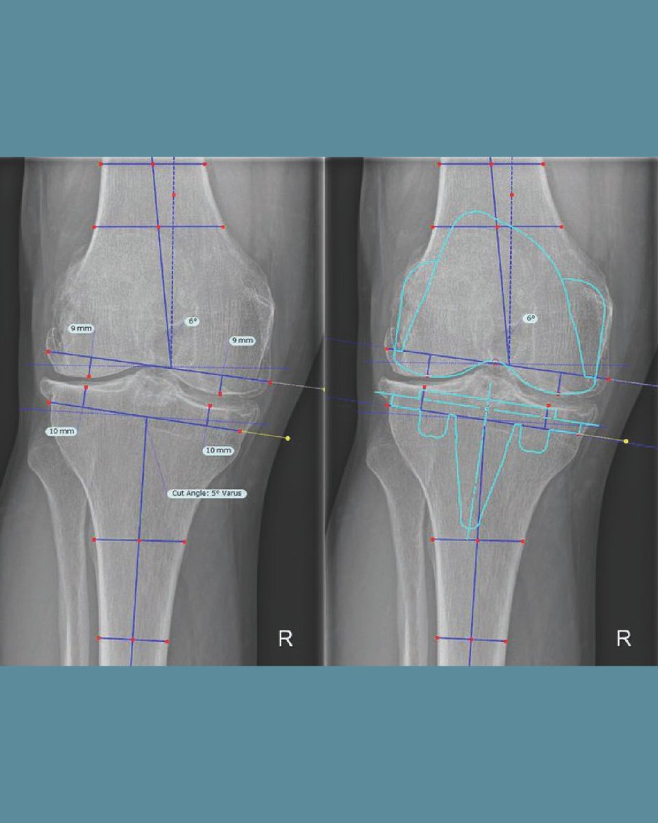 Bone & Joint 360 tweet media