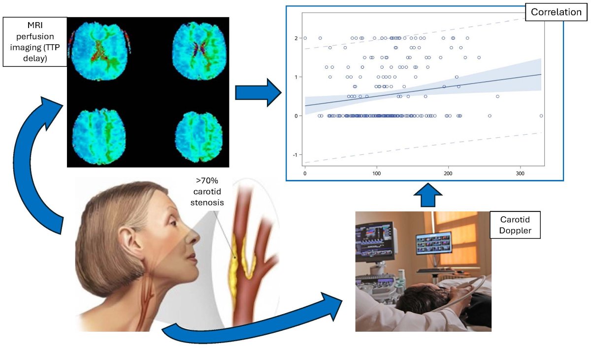StrokeAHA_ASA's tweet image. Article Commentary: “Relationship Between Degree of Stenosis and Time-To-Peak Delay in High Grade Asymptomatic Carotid Artery Disease”

In this #BloggingStroke post, Natalie Neale discusses #Stroke article by Marshall et al. ahajournals.org/do/10.1161/blo…