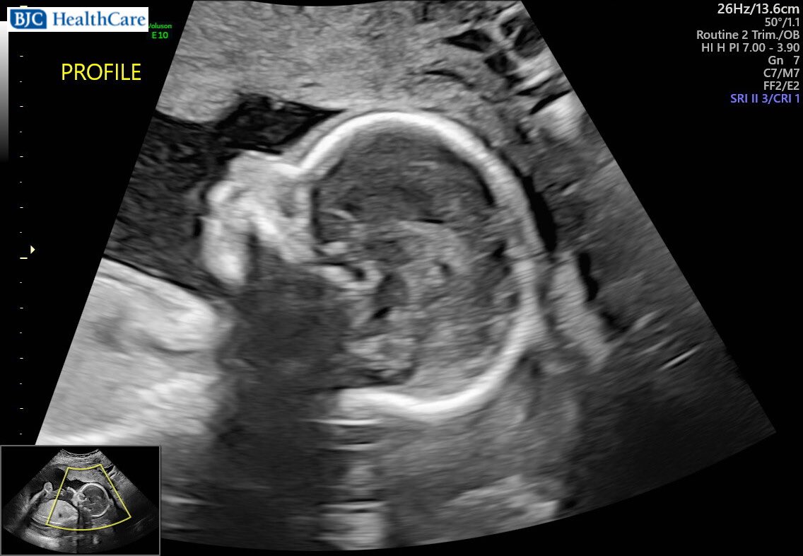 jimmy greenleaf jr. tweet media