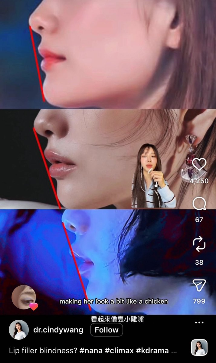 rnz 🍌 tweet media