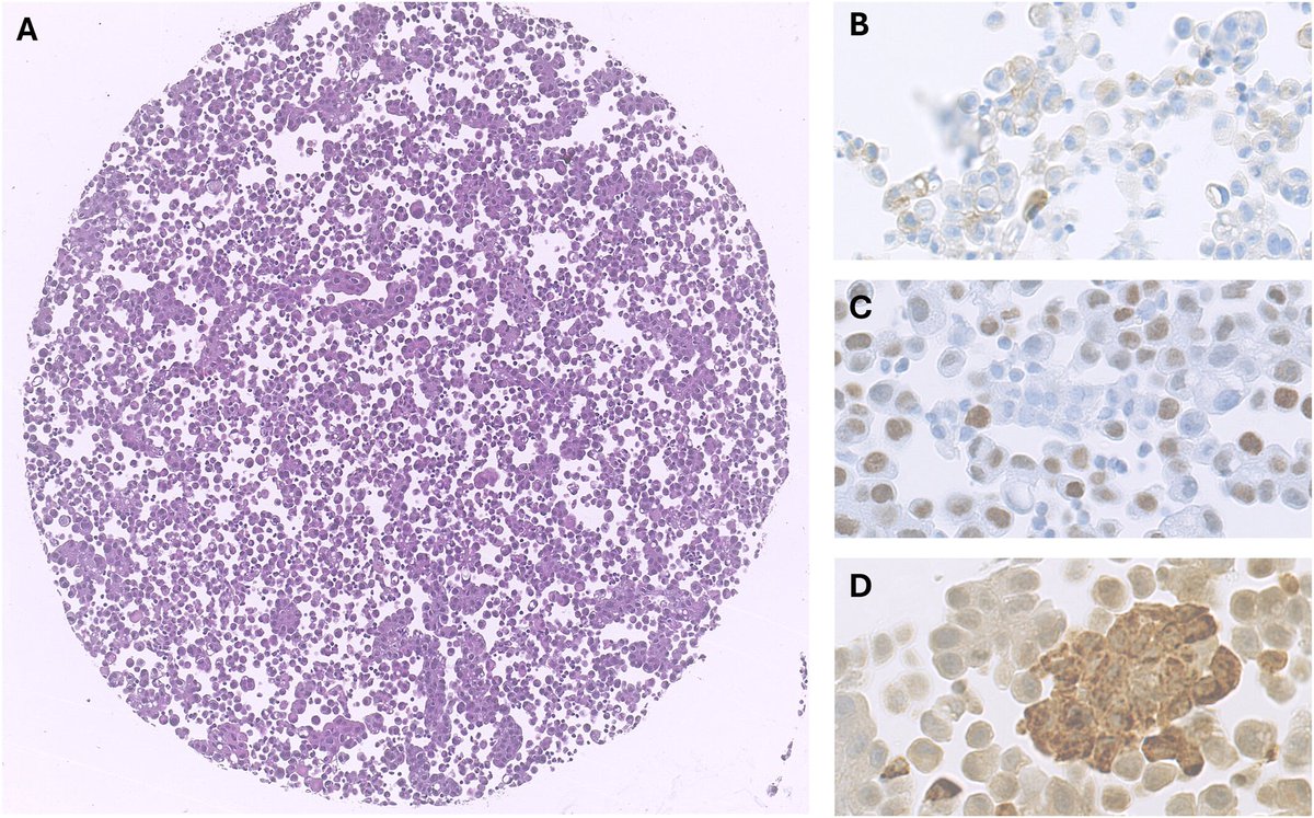 Cancer Cytopathology tweet media