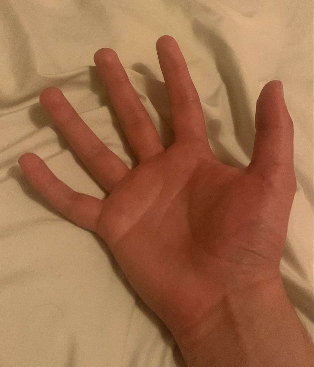 Zanjo 🗡️🐍 Immortal Samurai tweet media