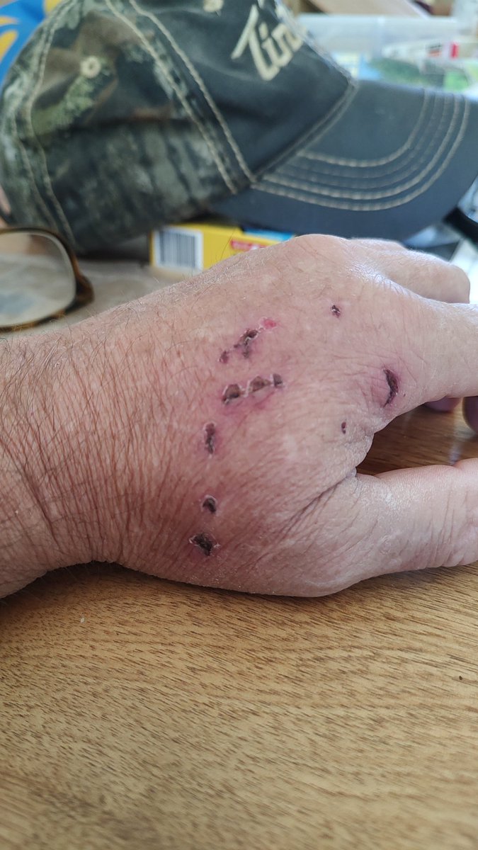 Bryan Kitchens tweet media