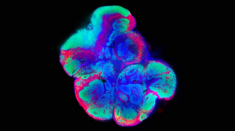 RarasReales's tweet photo. 🔬⚗️🥼 Investigación #EnfermedadesRaras.
El ISCIII inicia un proyecto pionero para estudiar el ‘mapa del cerebro’ en el Síndrome de #Kleefstra.
El proyecto tiene como objetivo comprender mejor cómo se organiza y funciona el cerebro en las personas con esta alteración y se va a realizar en colaboración la Asociación de pacientes Kleefstra España y el apoyo de @FEDER_ONG.
https://t.co/MH8943s93F