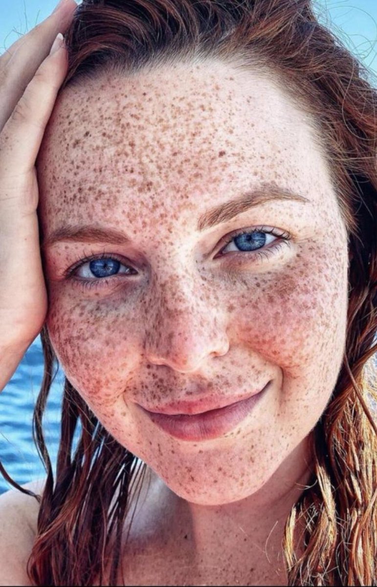 FreckledFace111's tweet image. #FreckledFace 💙#Beauty