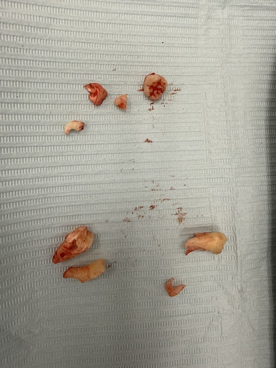 OG Anunoby Addict tweet media