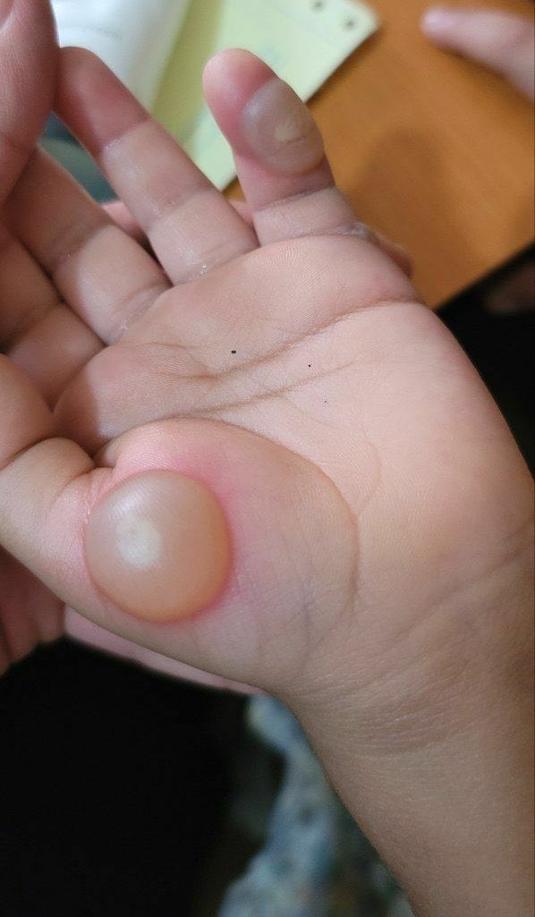 Dr.Haitham Hamoud | د.هيثم tweet media