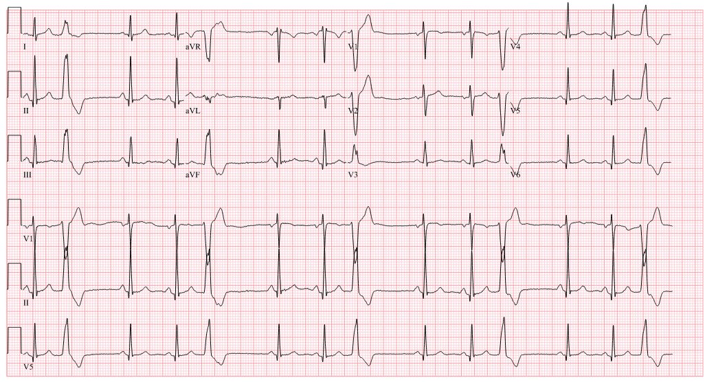 syamkumarmd's tweet image. Likely SOO? #EPeeps