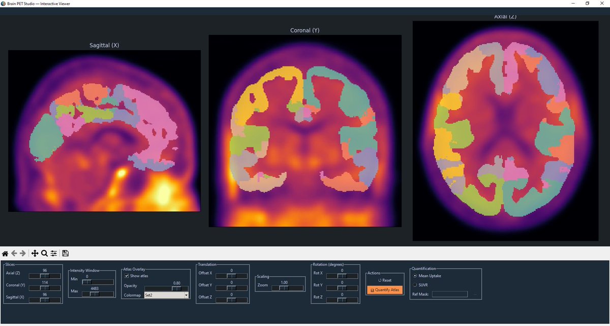 fardin_nb's tweet photo. Excited to finally share this.
BrainPET Studio is a free, user‑friendly desktop tool for PET brain imaging analysis now on GitHub.
Load a PET scan, choose any MNI atlas, and get regional SUVR results in minutes. Paper coming soon.
https://t.co/GAxLHlDdbr https://t.co/n9pivt3ldi