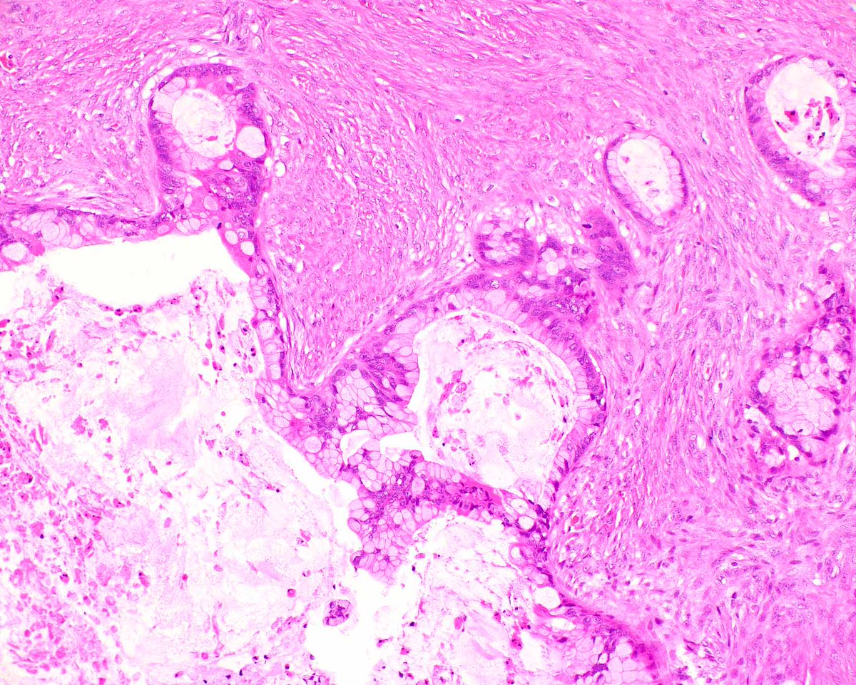 Modern Pathology tweet media