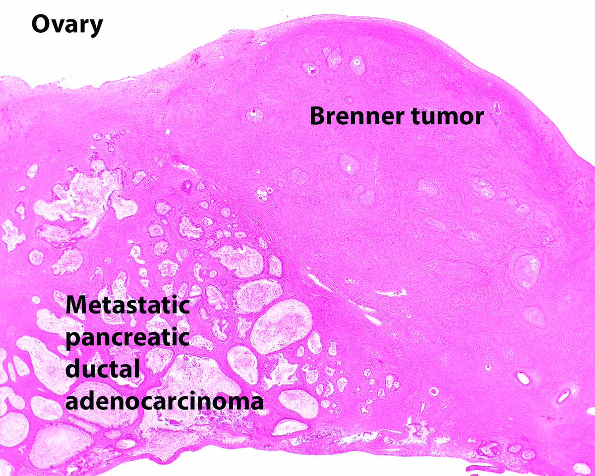 Modern Pathology tweet media
