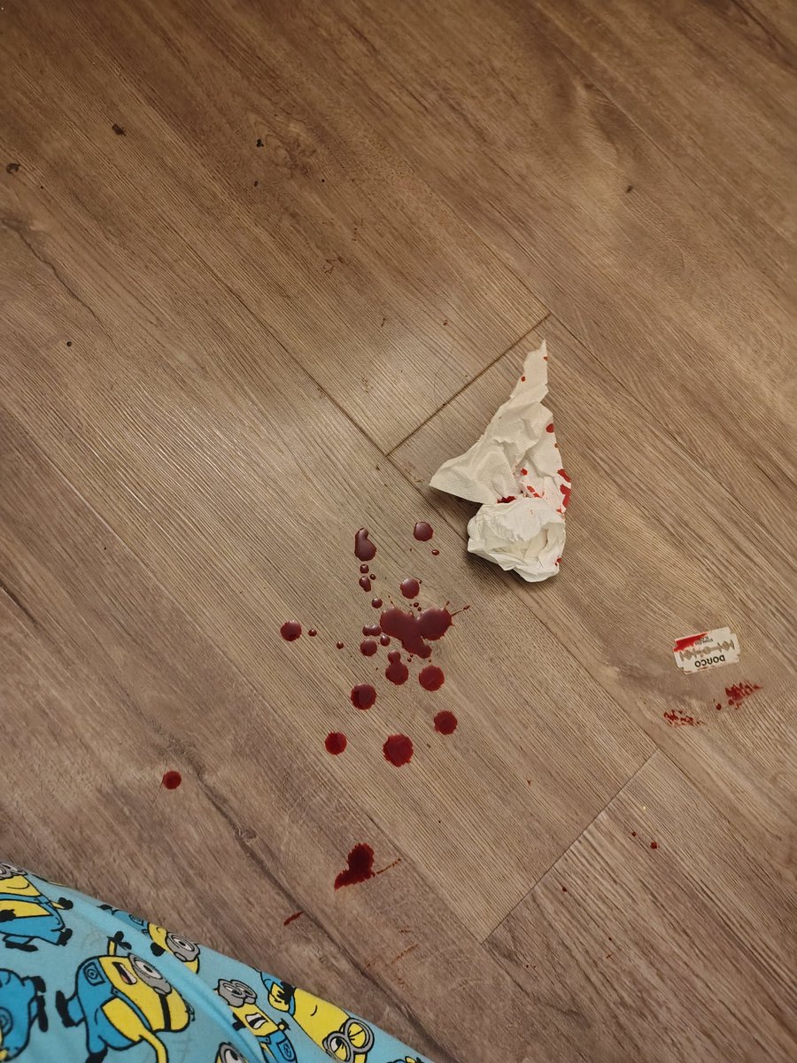 KARKAT OF #SHEDTWT 🩸 tweet media