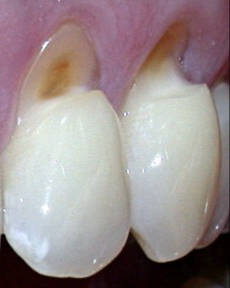 ☣️ Pleb Kruse = BTC foundationalist in exile 🟩🔆 tweet media