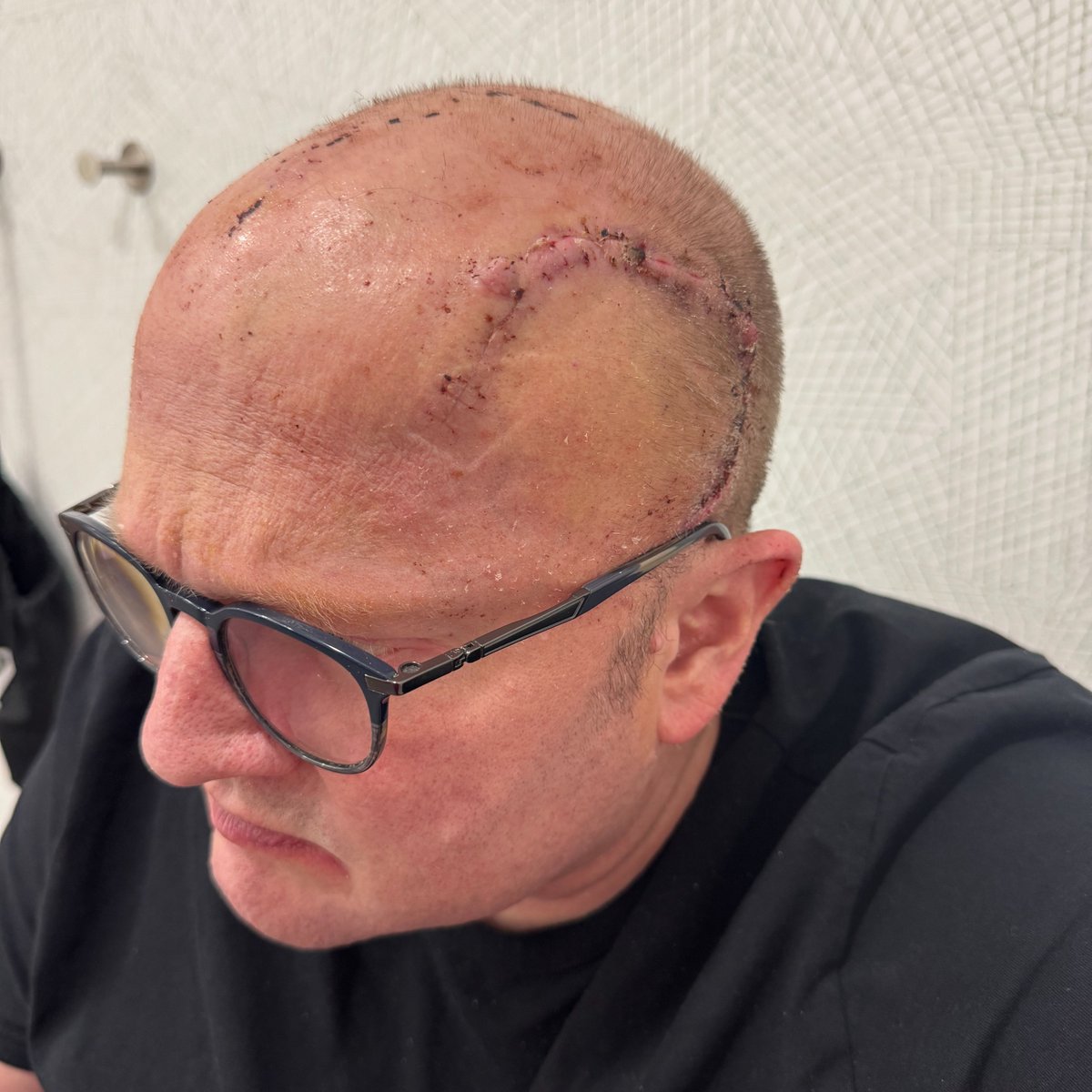 I want to clear up a big misconception: the BCI isn't on my right hand nor lodged inside my forehead.

And I'm certainly not going to tip the side of my head down against the card reader to pay for groceries at Costco.

I hope that alleviates your concerns. #AintTheMark #CmonMan