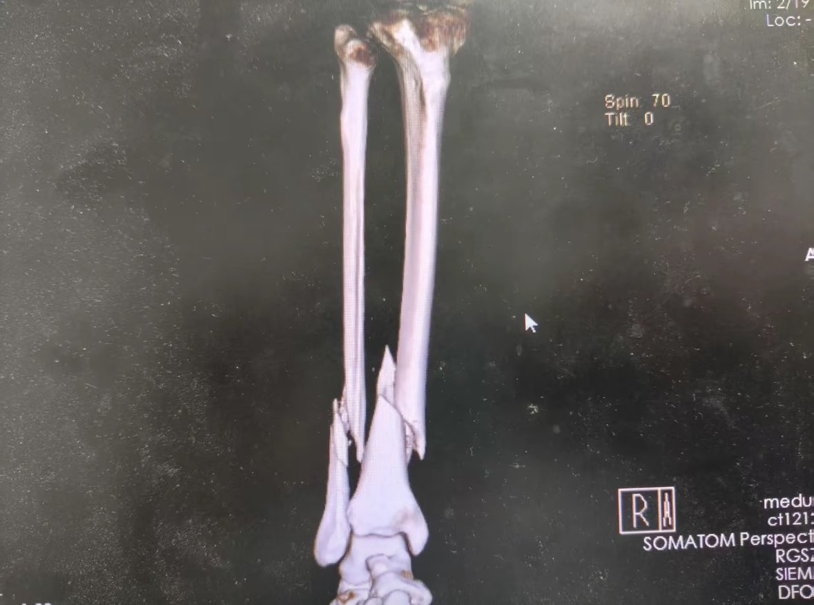 秋怡妹妹 tweet media