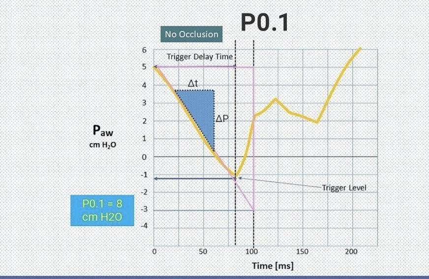 🔹️Evaluación del drive inspiratorio y del esfuerzo respiratorio en pacientes críticos en la cabecera del paciente🛌                                           
🧑🏻‍⚕️👩🏻‍⚕️Concepto central⬇️                         🫁En ausencia de herramientas avanzadas como la presión esofágica (Pes)