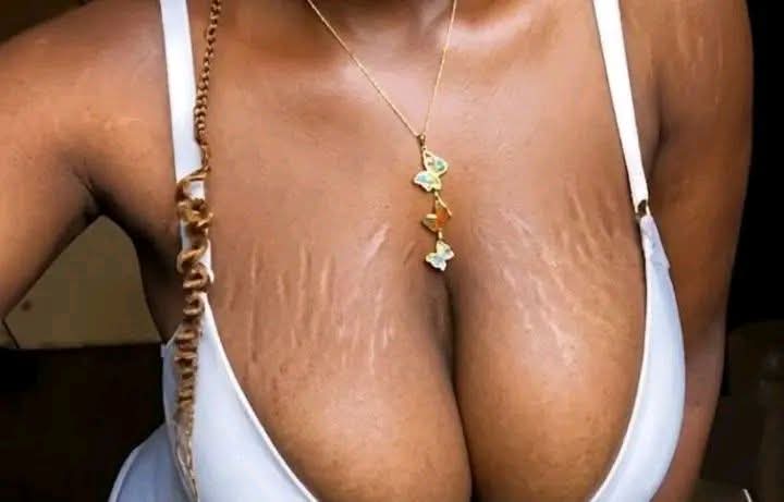 The major tweet media