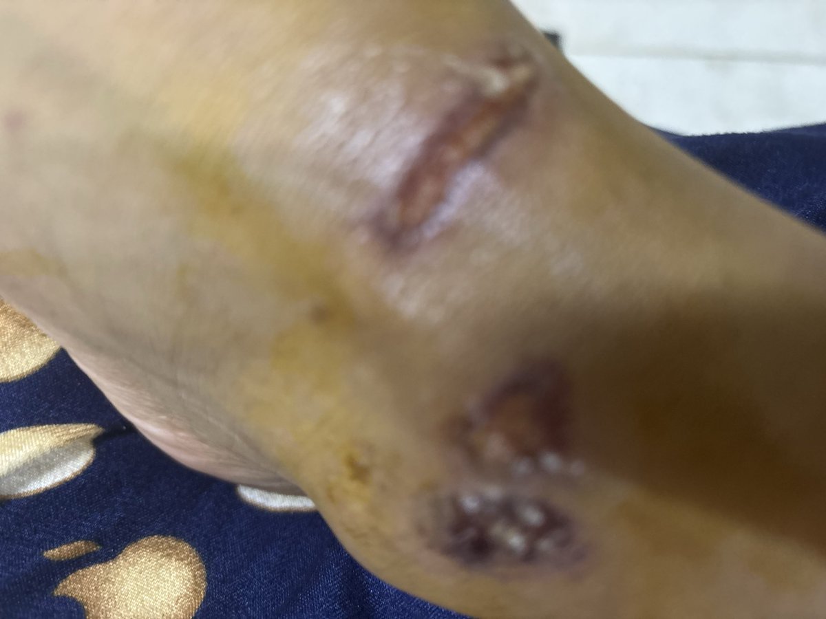 K7 ☈🇦🇪 tweet media