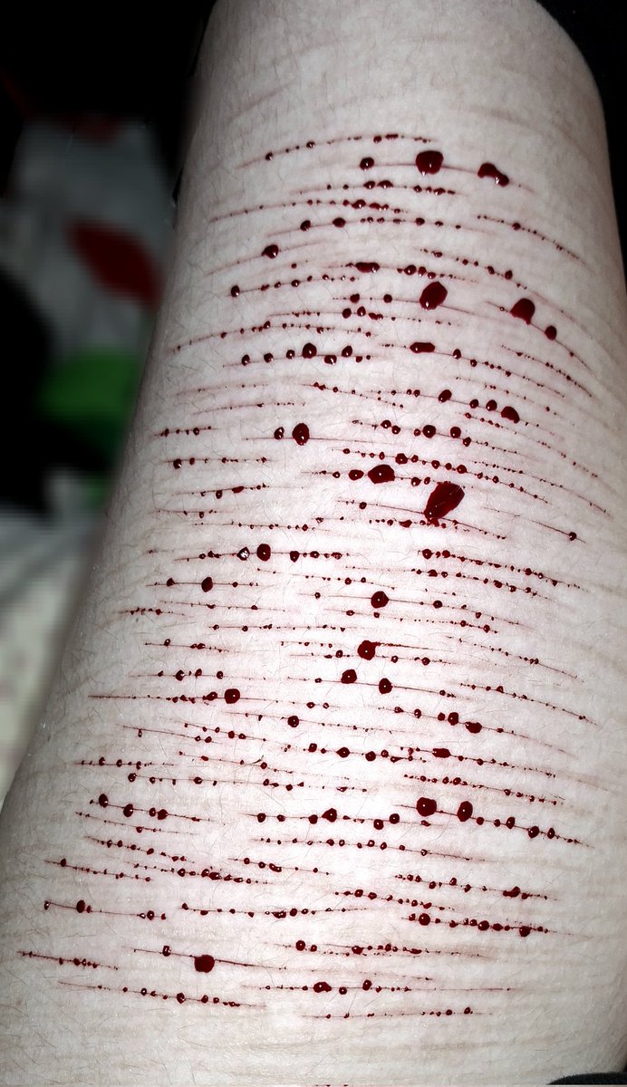 Quibyyyyy's tweet photo. These cuts sting so bad, pray for my legs tmrw https://t.co/QNadK13CDU