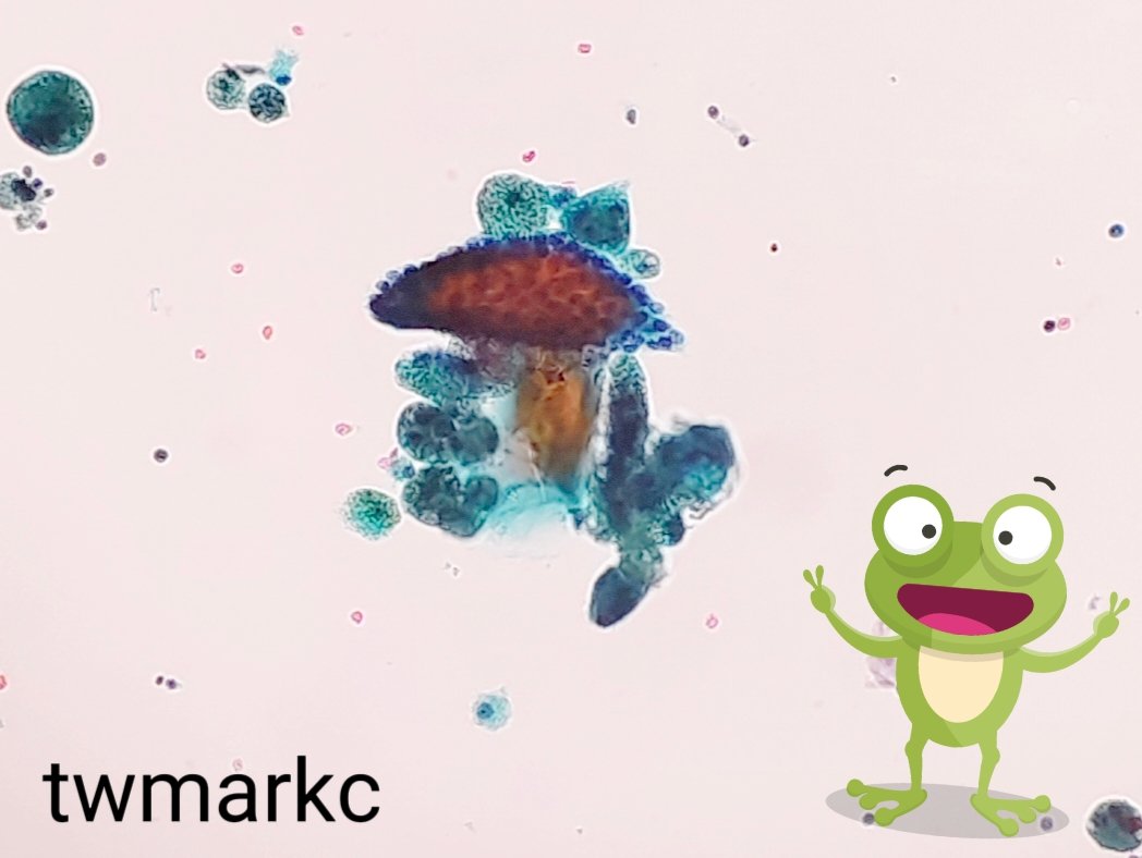 Mark CC Chen, M.D. FIAC tweet media