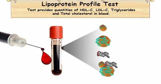 healthyojas's tweet image. Lipoprotein profile test, how to use it? buff.ly/wD6N45K #Cholesterol #HighCholesterol #LipoproteinProfileTest #LipidProfileTest