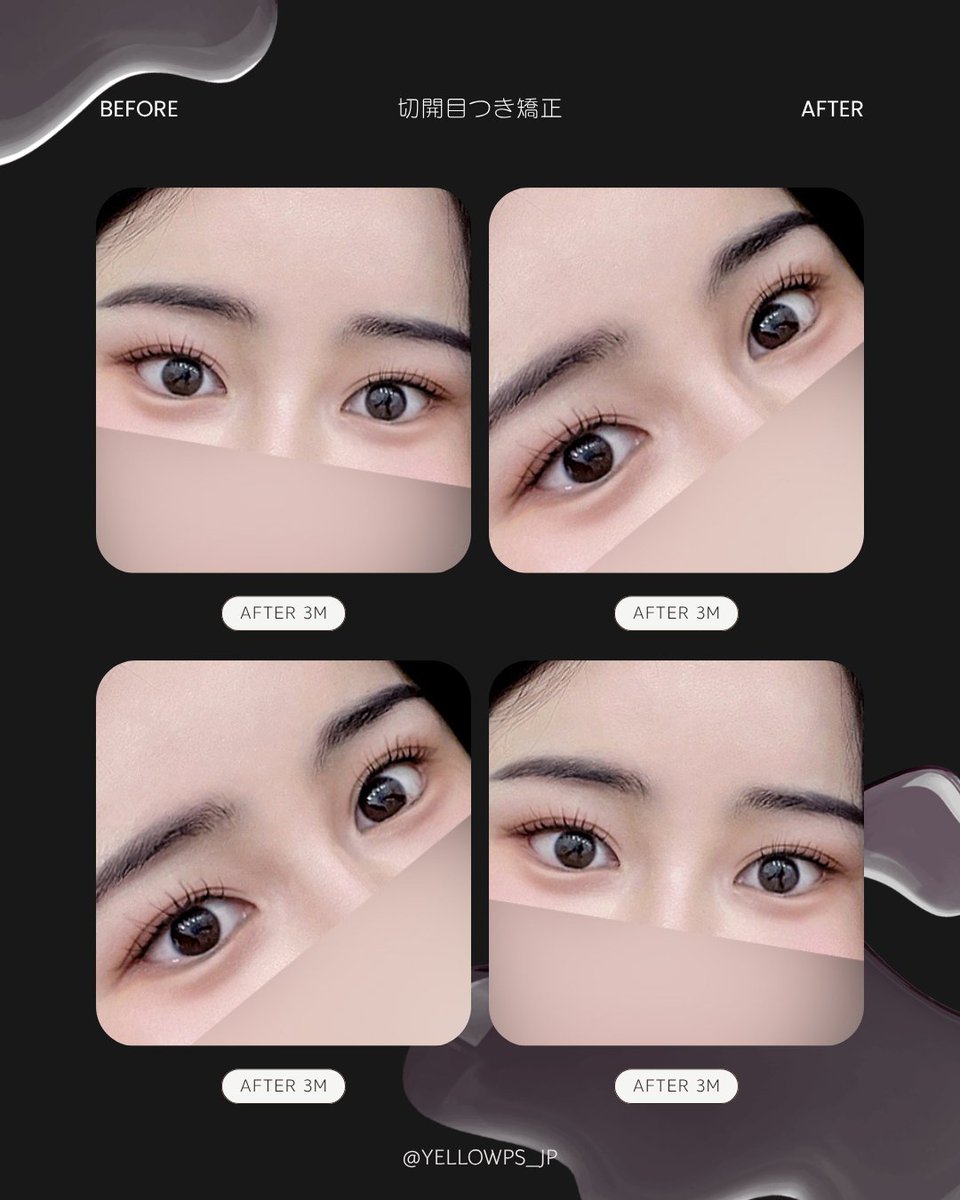 💛イエロー美容整形外科(公式)💛 tweet media