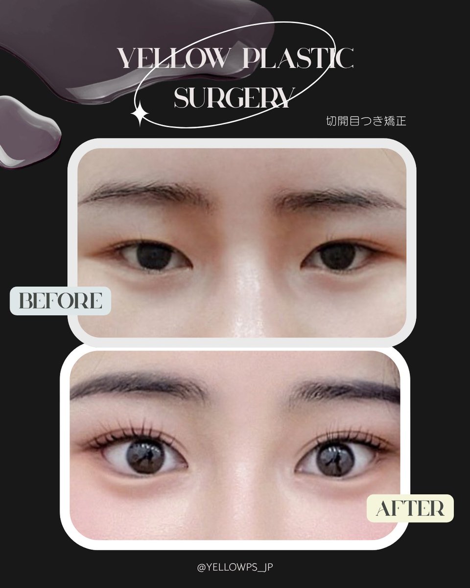 💛イエロー美容整形外科(公式)💛 tweet media