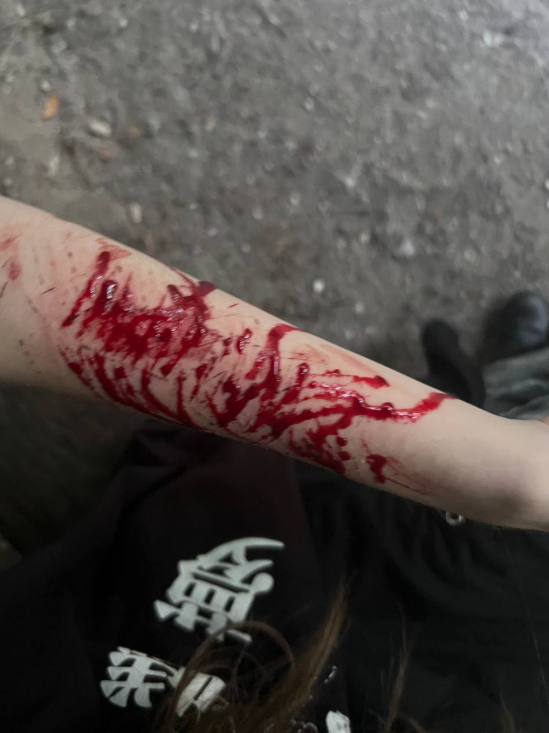 𓆩♱ badger .ᐟ ҂🩸 tweet media