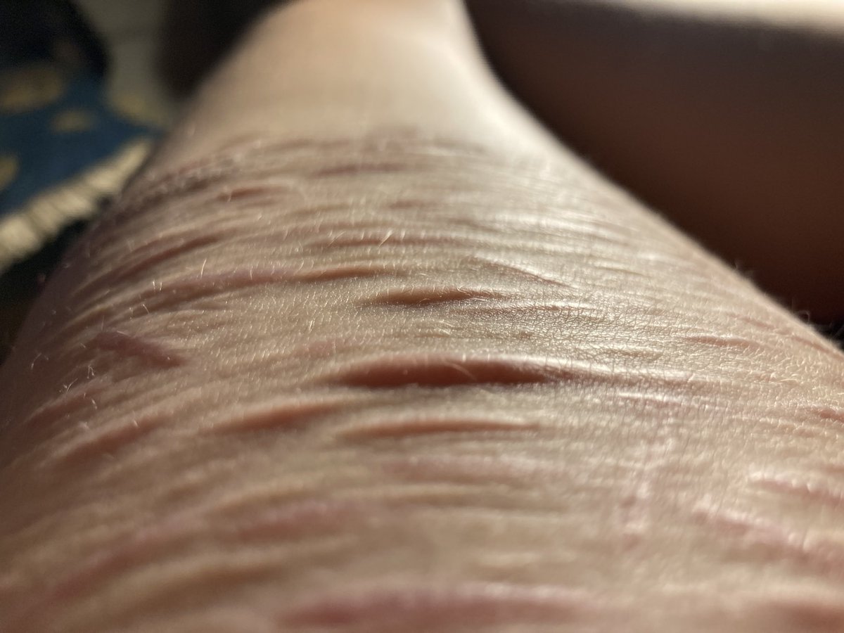 𓂃 ˖ 𝐄𝐳𝐫𝐚 🪒𝐭𝐰𝐭!! ࿐✮ tweet media