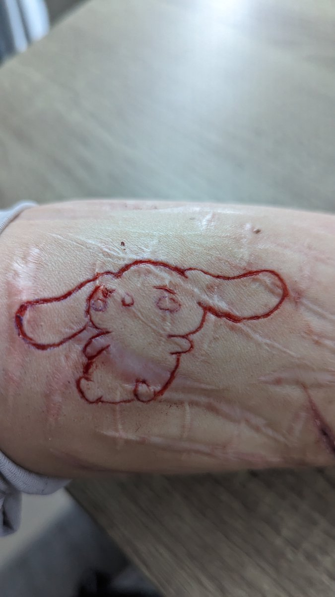 Tillytilly tweet media