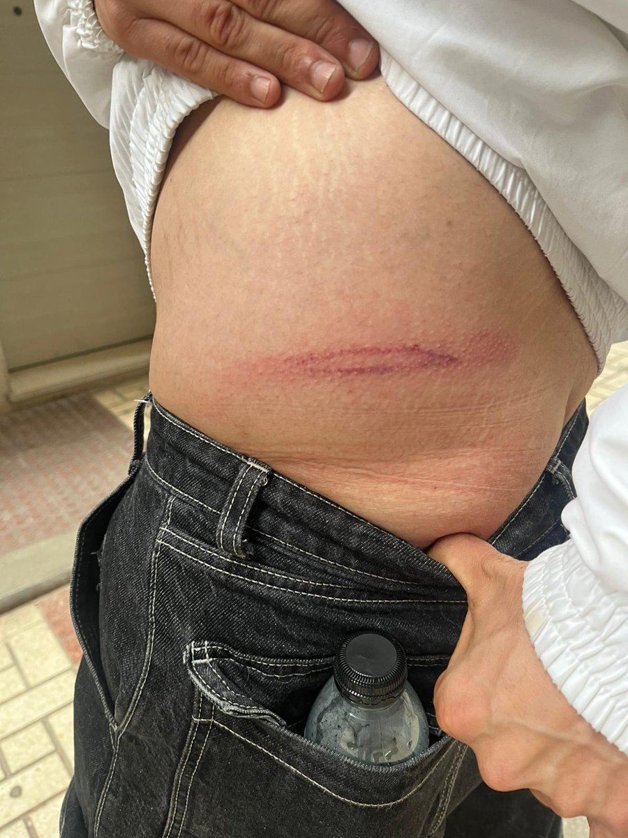 SindicaEstudian's tweet photo. 🔴 IMPORTANTE DIFUSIÓN. La policía detiene a 2 compañerxs durante un desahucio en Málaga ¡Basta ya de brutalidad policial! 

Exigimos la liberación inmediata de los detenidos ‼️

Todxs a la Calle Rodríguez Berlanga para denunciar este atropello. https://t.co/TIDyMXOG91