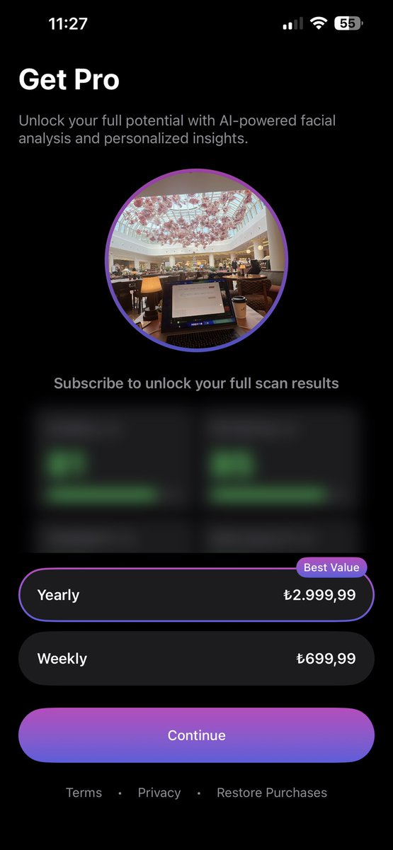 onur ozcan tweet media