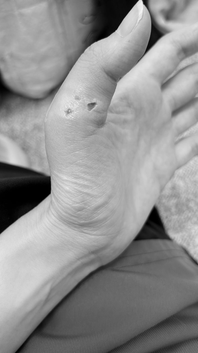 チロル tweet media