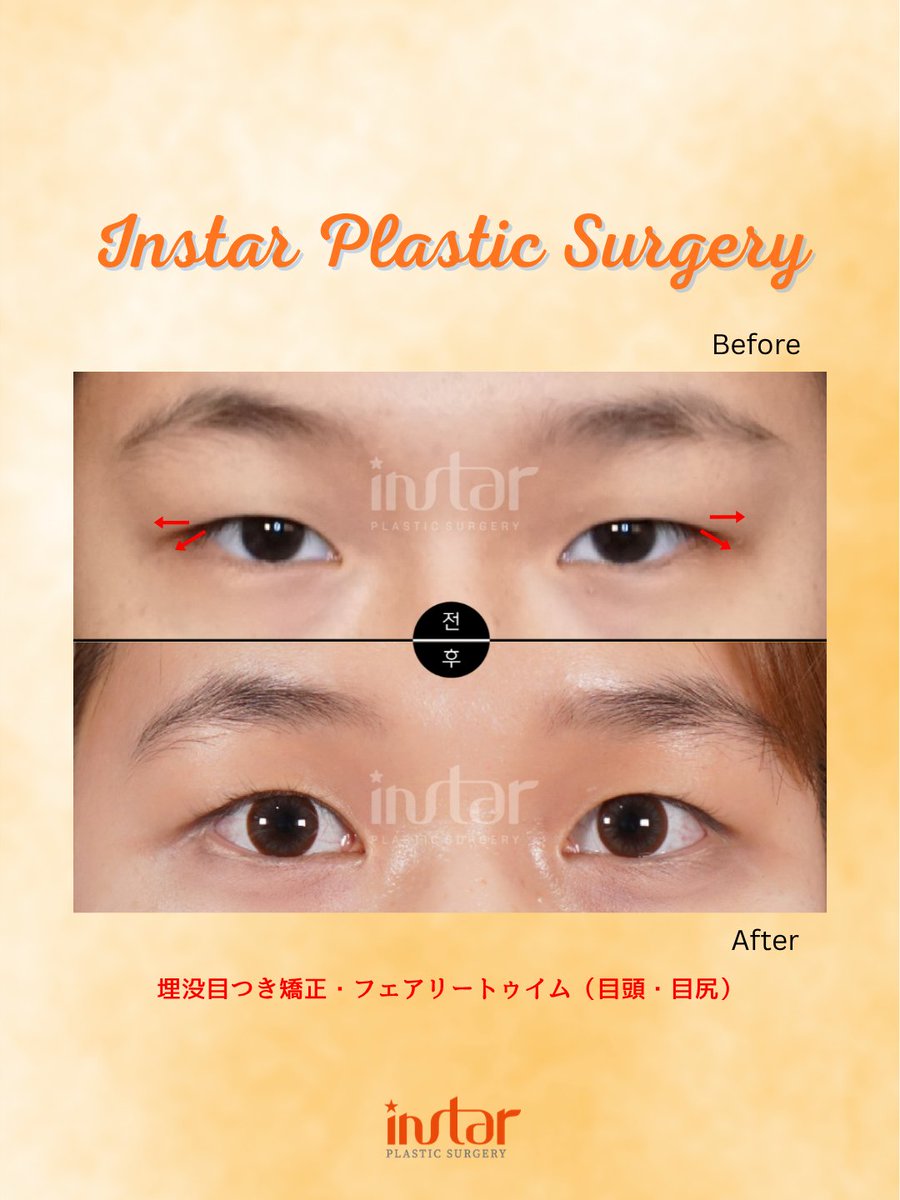 ⭐️instar整形外科⭐️ tweet media