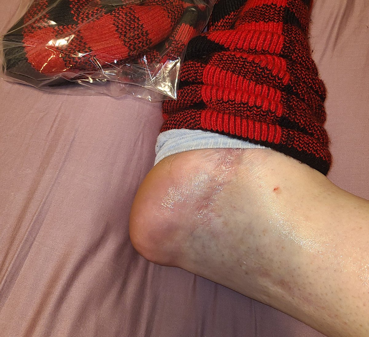 GothicSmell tweet media