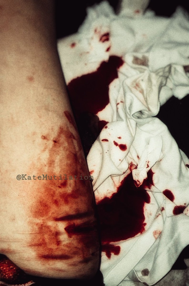 KateMutilation's tweet photo. #shtwt https://t.co/DyPNK8XhoB