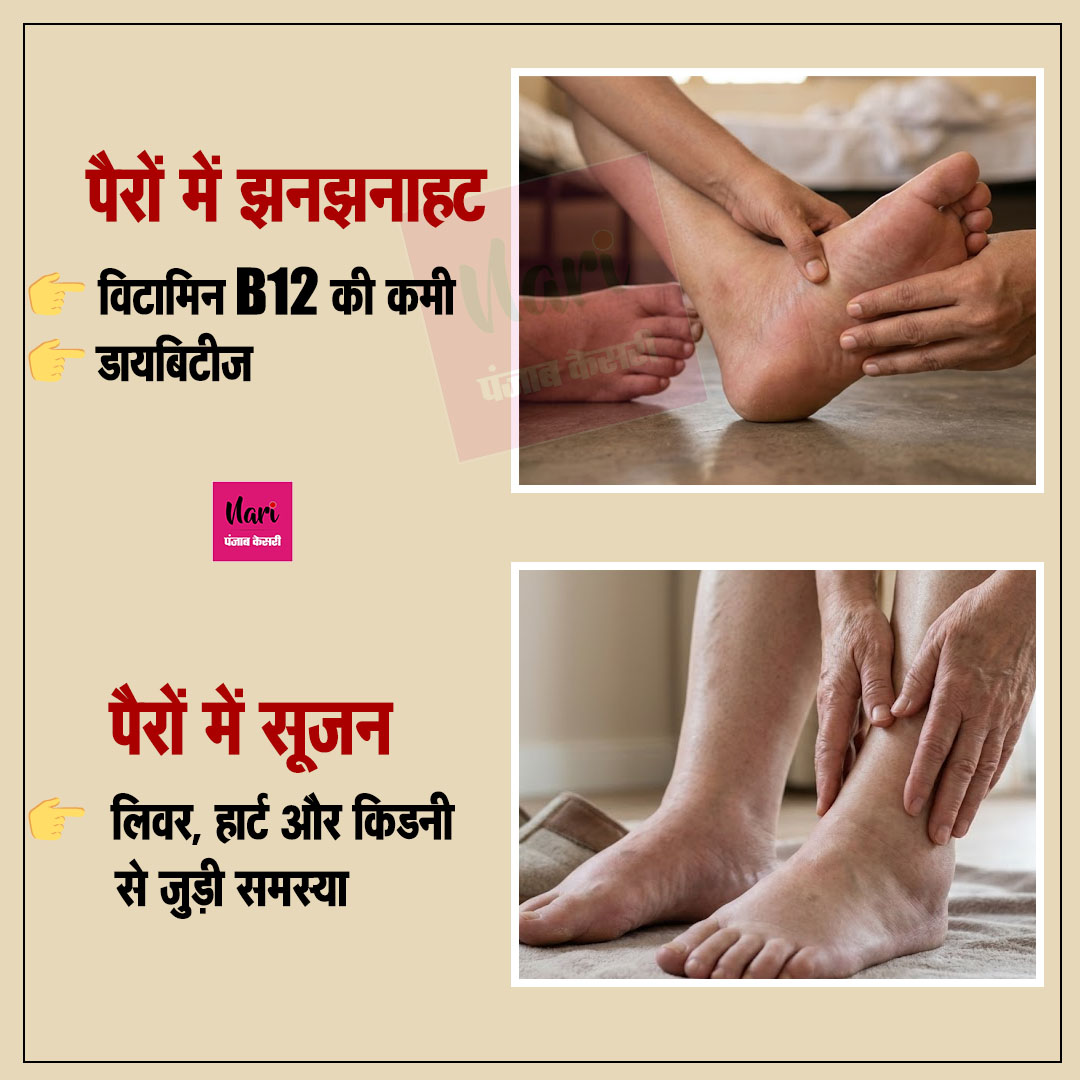 NariKesari's tweet image. 👣 पैरों के लक्षण बताते हैं शरीर की बीमारी – क्या आप पहचानते हैं ये संकेत?

#Health #FootCare #BodySignals #HealthyLife